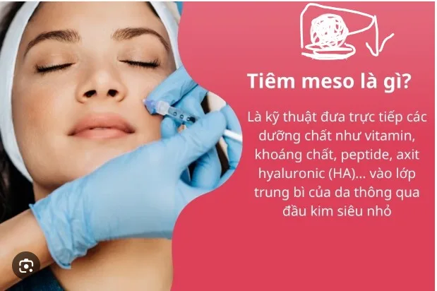 lieu-phap-tiem-meso-la-gi-co-hai-da-khong-a1